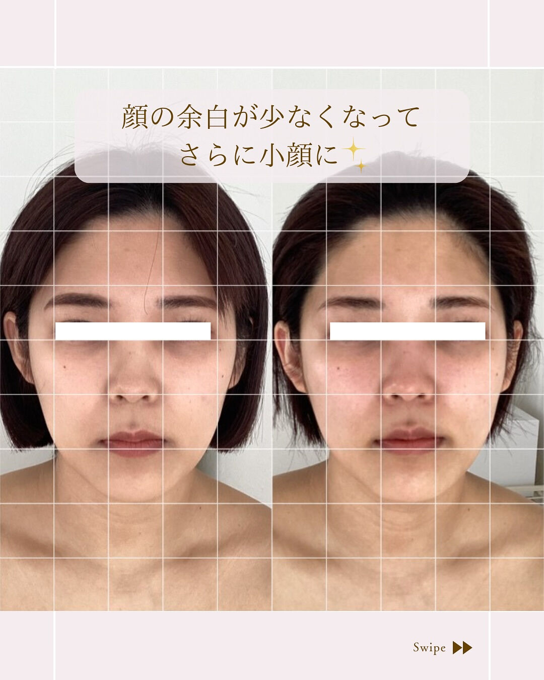 ⌇顔の余白が気になる方！
