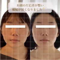 画像1414：お顔の余白を減らす！