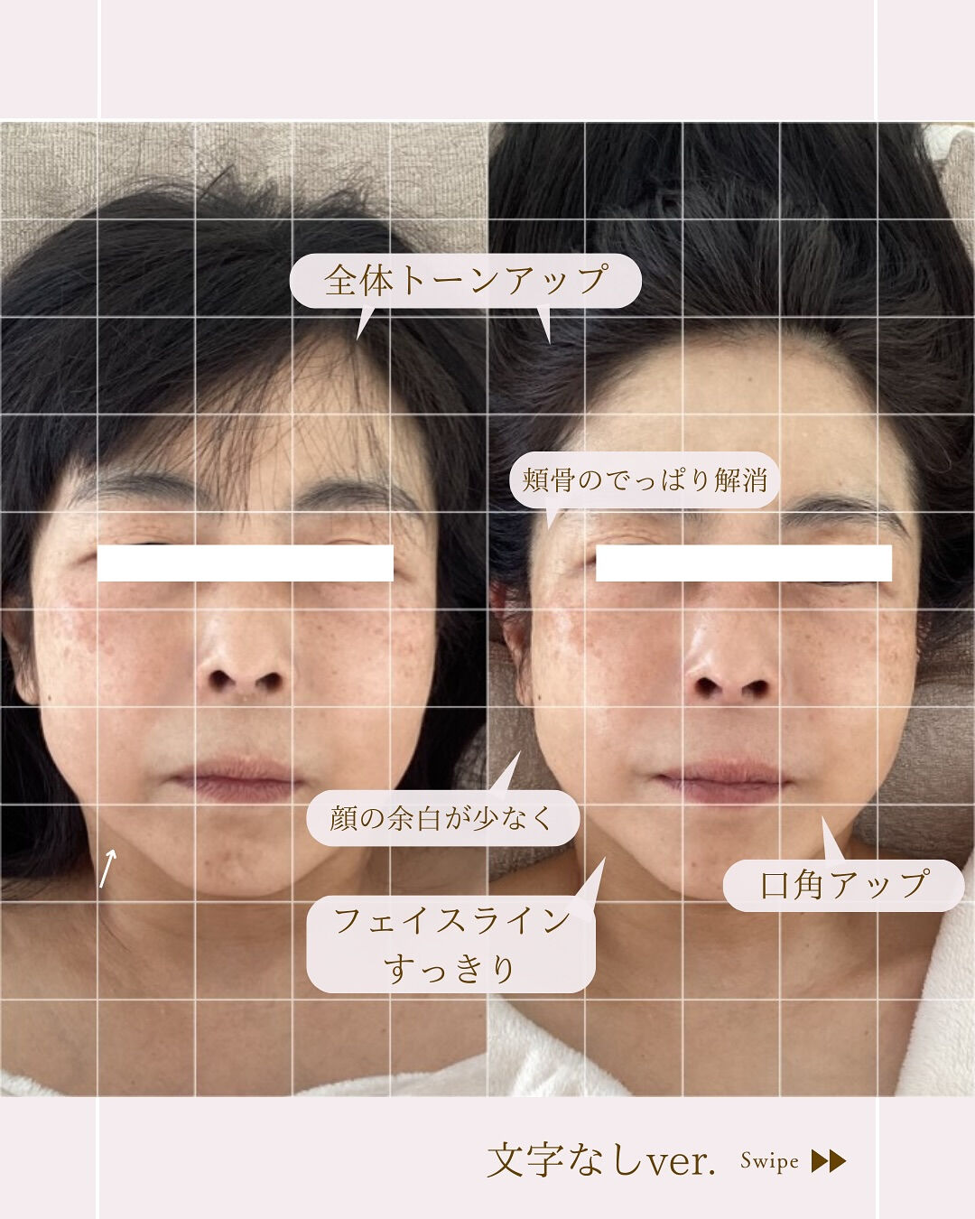 ⌇小顔は今からでも遅くない！