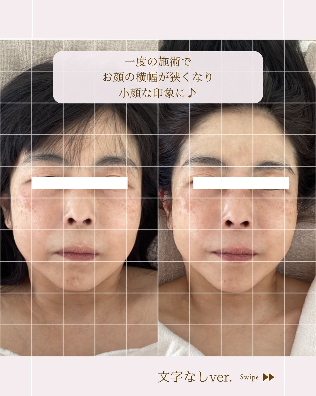 ⌇小顔は今からでも遅くない！