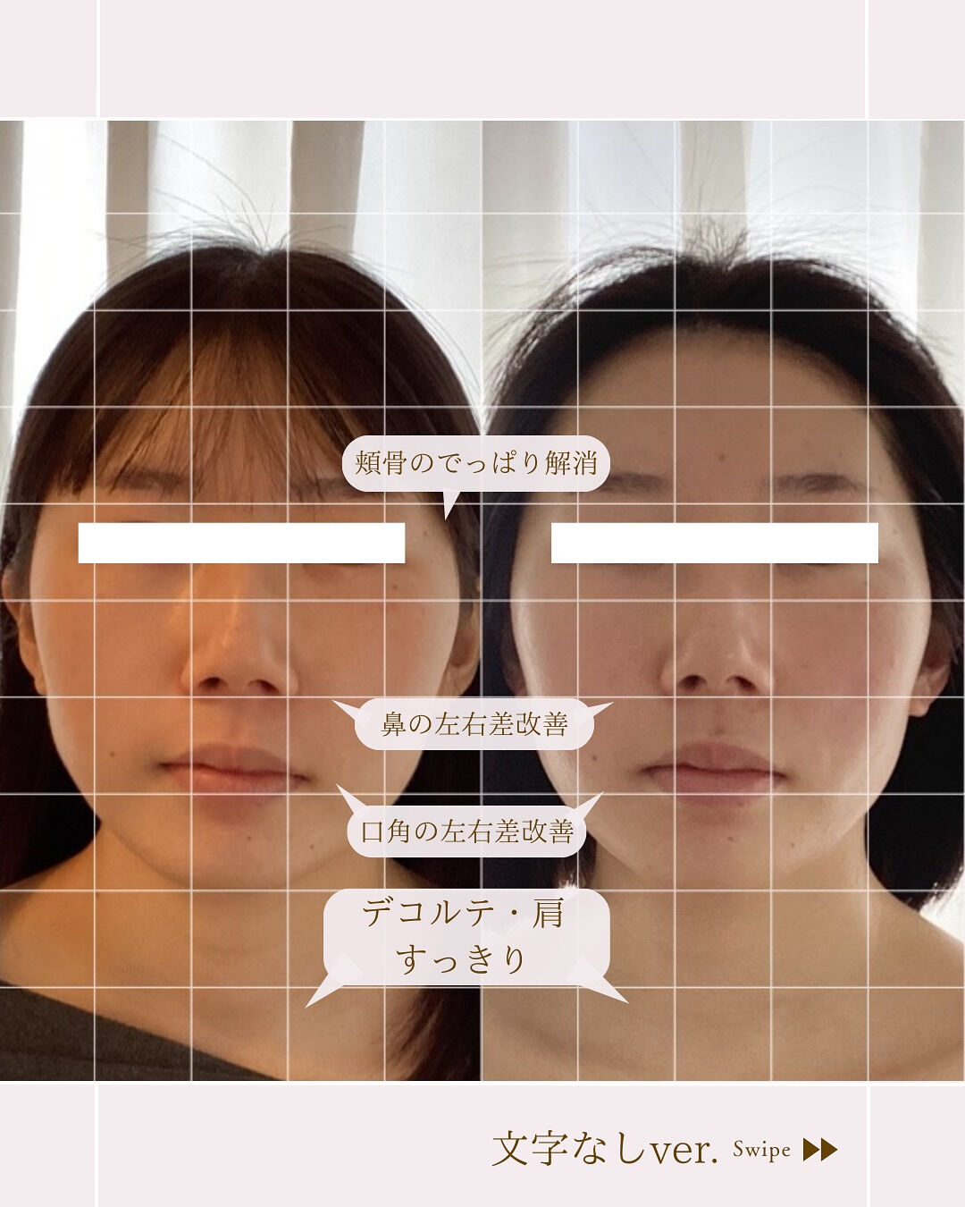 ⌇お顔の歪み改善しましょう⸝⋆