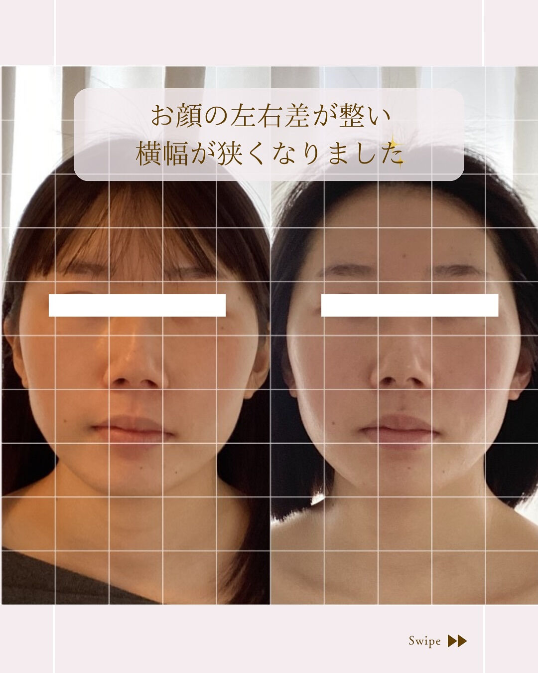 ⌇お顔の歪み改善しましょう⸝⋆