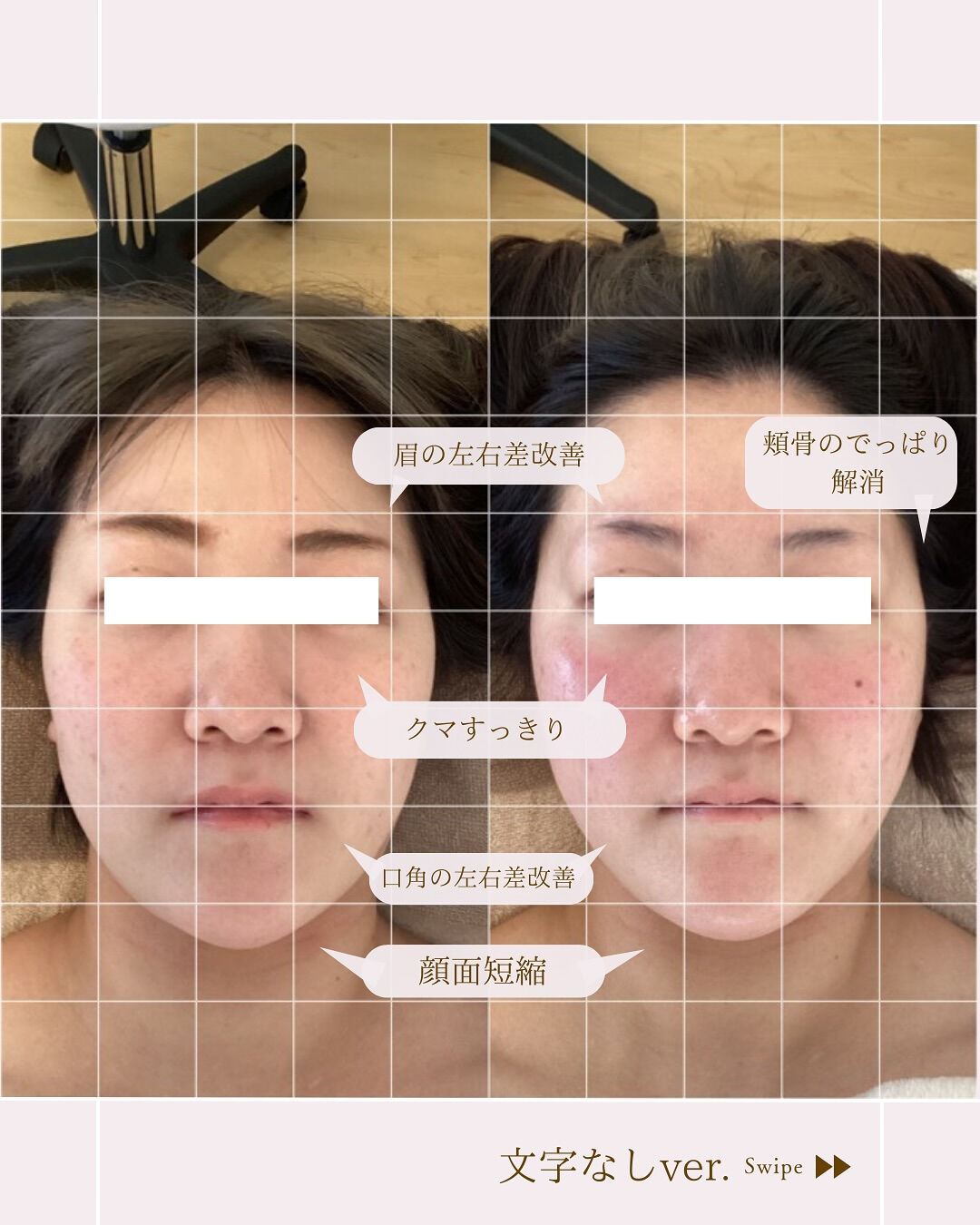 ⌇1回で顔の余白をなくす⸝⋆