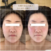 画像1477：お顔の余白を減らす！