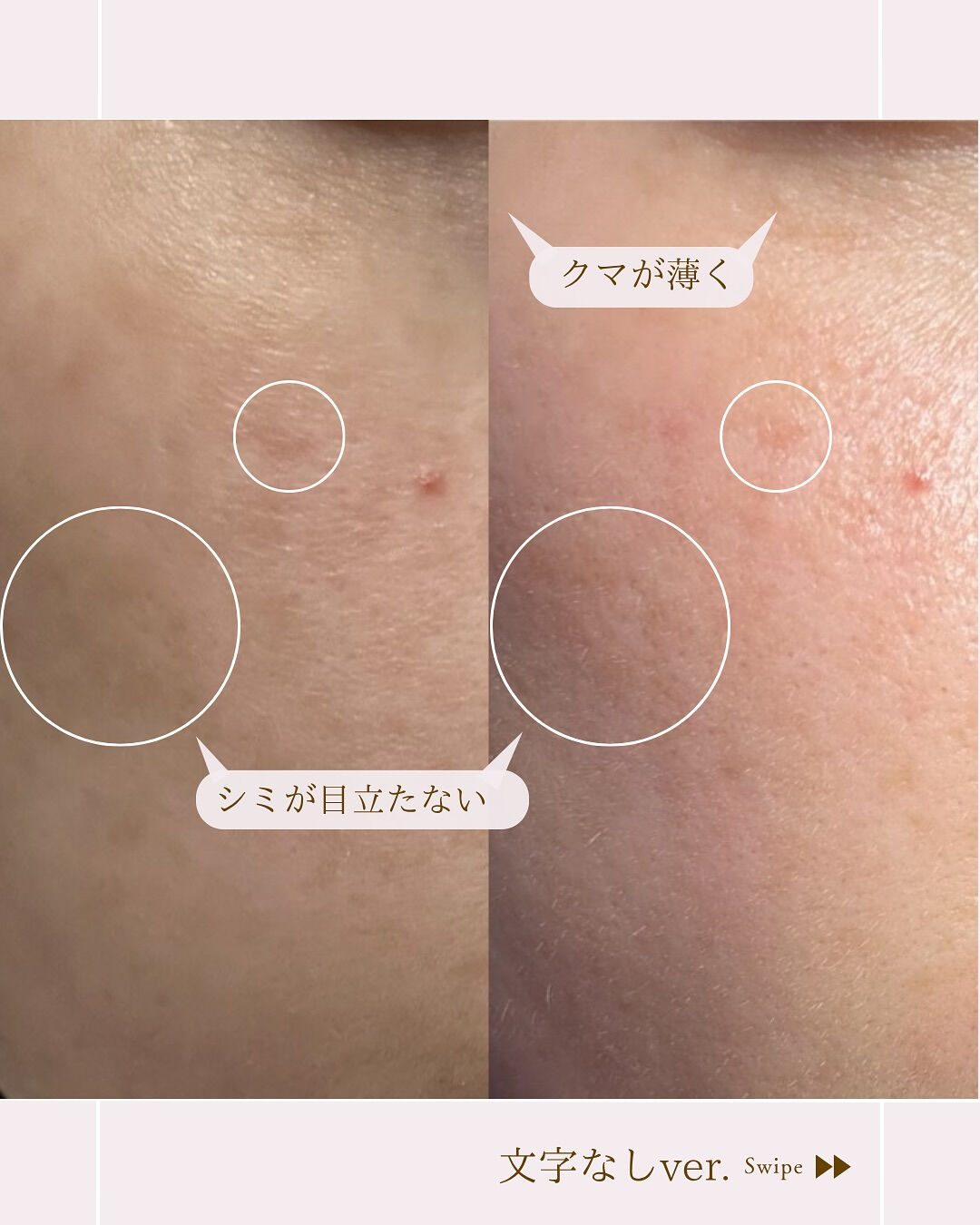 ⌇炭酸ジェルマスク6日間チャレンジ⸝⋆