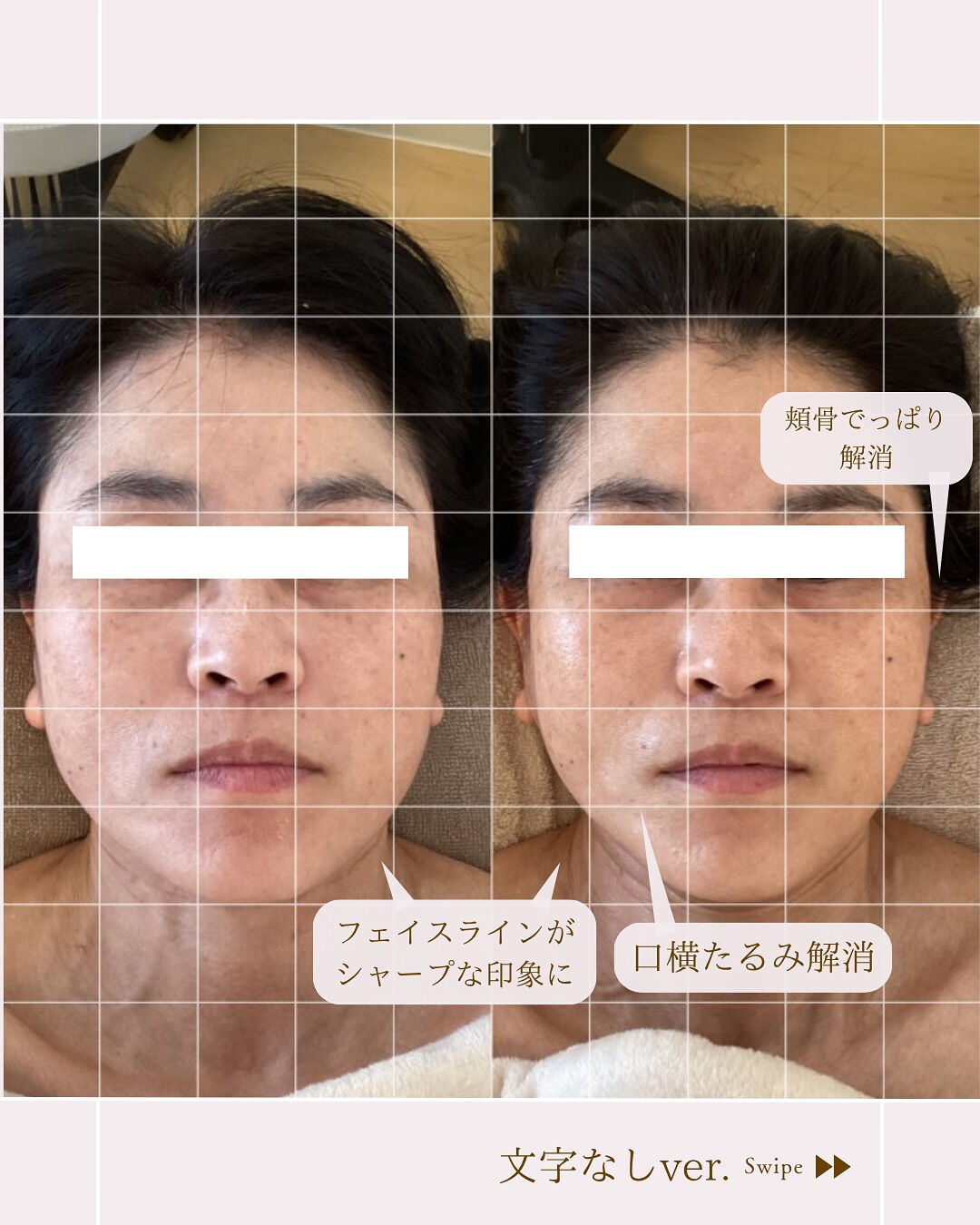 ⌇一度で顔がコンパクトに⸝⋆