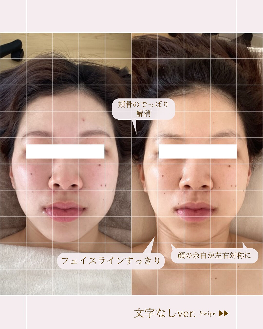 ⌇余白がなくなってお顔すっきり⸝⋆