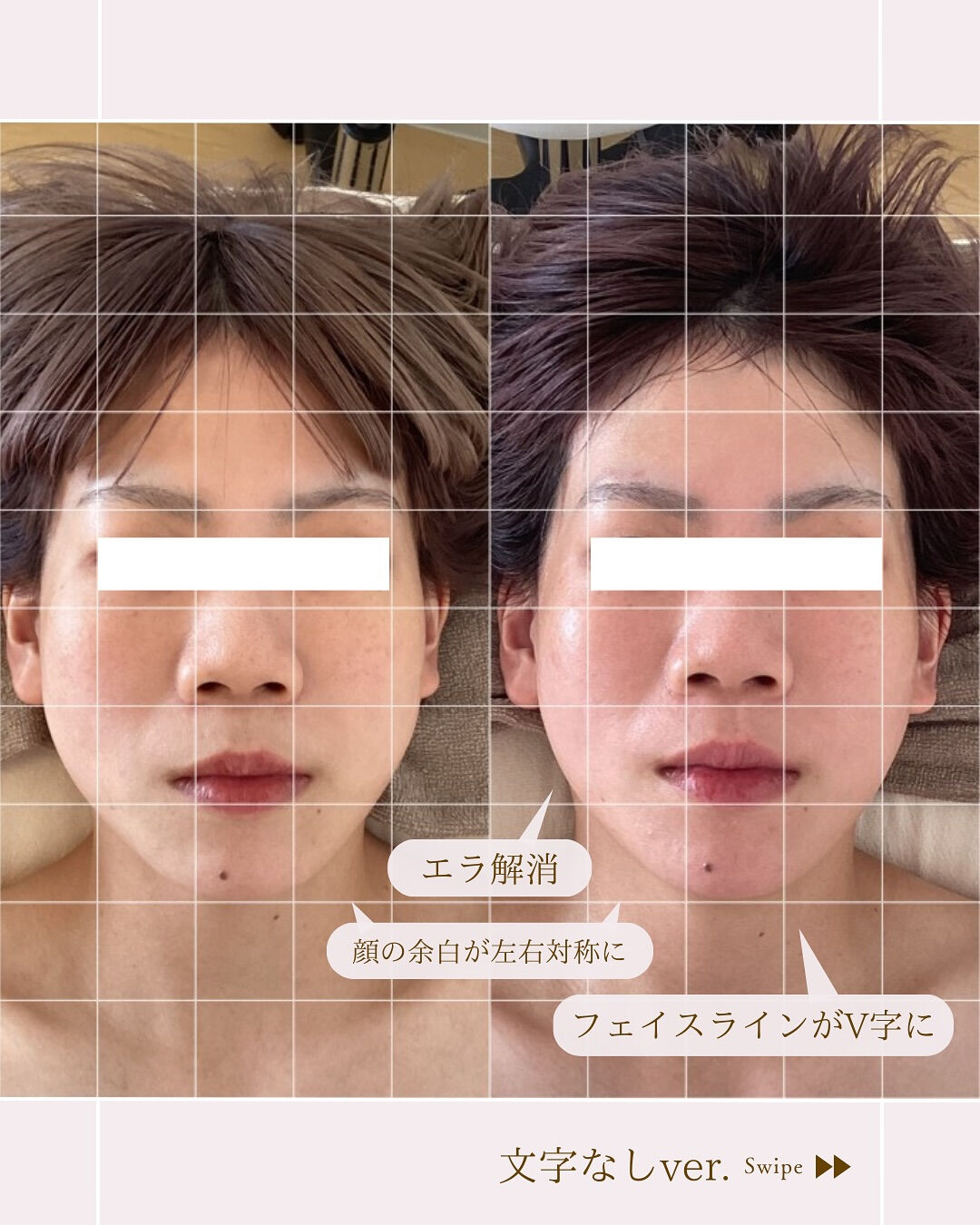 ⌇お顔をキレイなたまご型に…✧︎