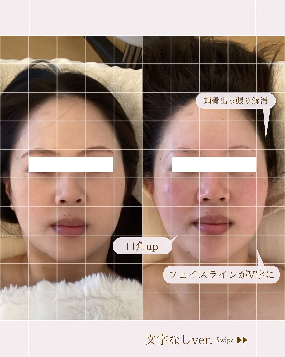 ⌇2026年は小顔になろう⸝⋆