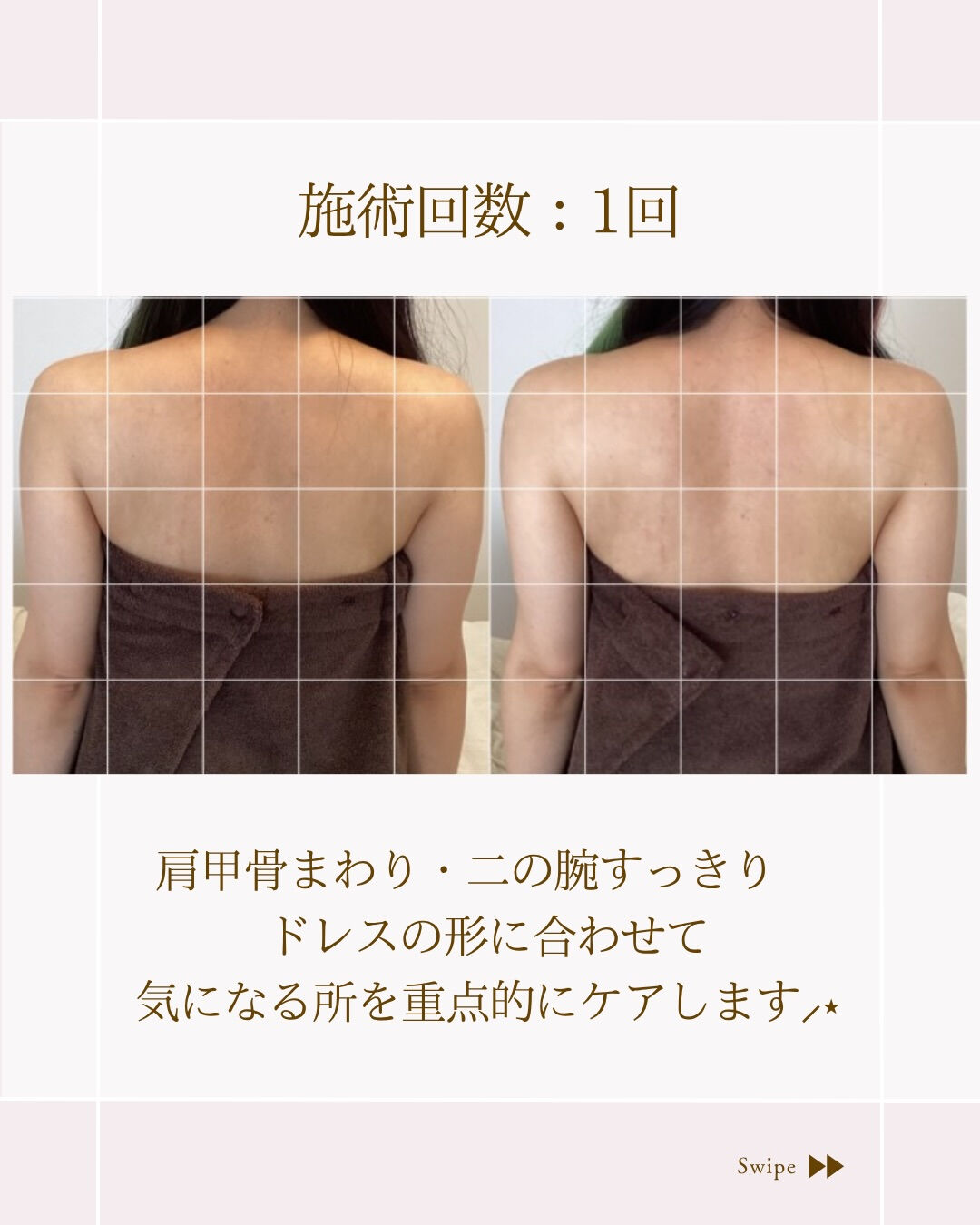 ⌇背中〜二の腕痩せしたい富山プレ花嫁様⸝⋆