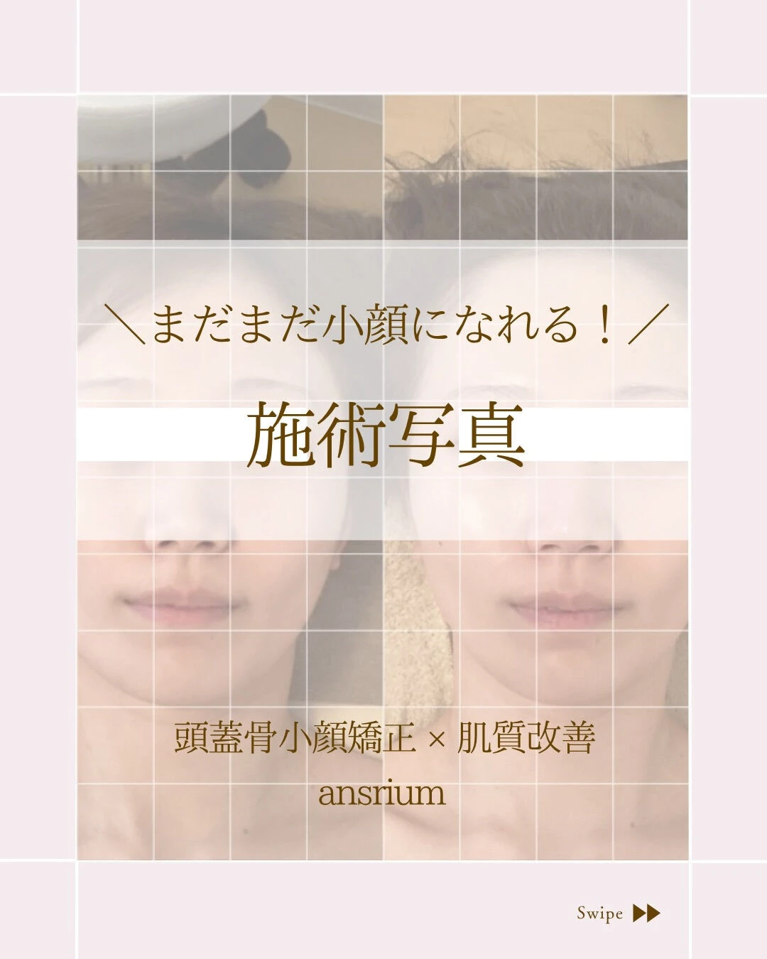 ⌇あなたもまだまだ小顔になれる⸝⋆