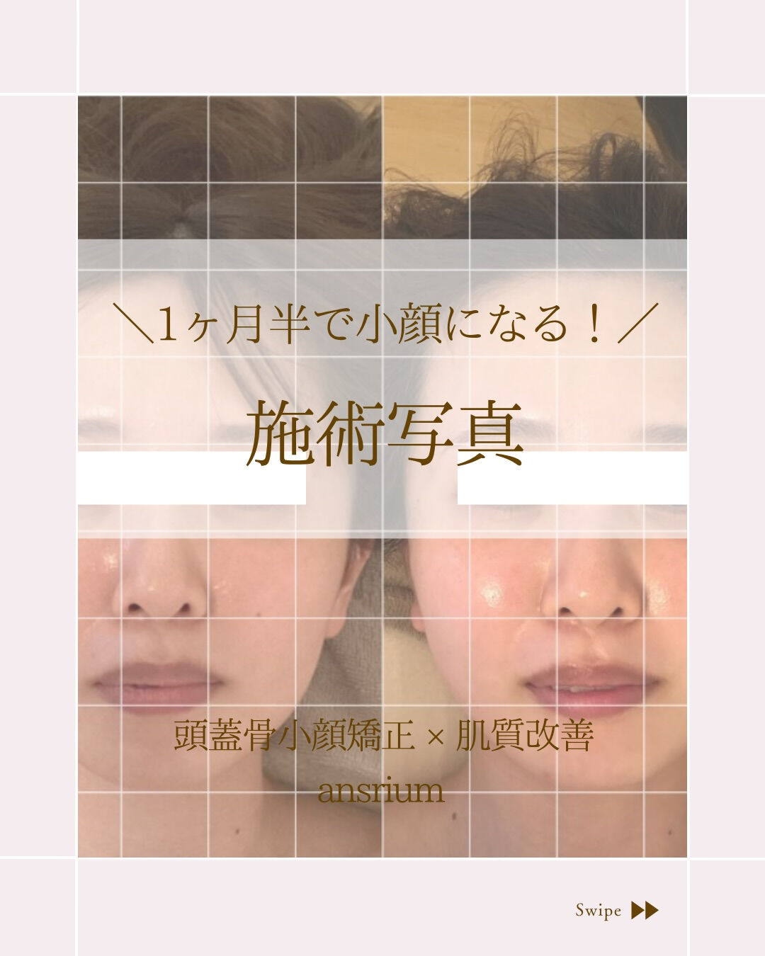 ⌇急いで小顔になりたい方！
