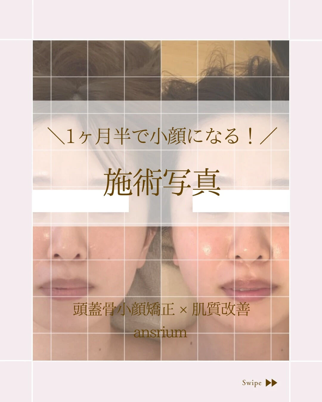 ⌇急いで小顔になりたい方！